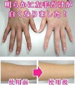 副 完璧 オーバーラン 石鹸 美白 Osingaconstruction Com