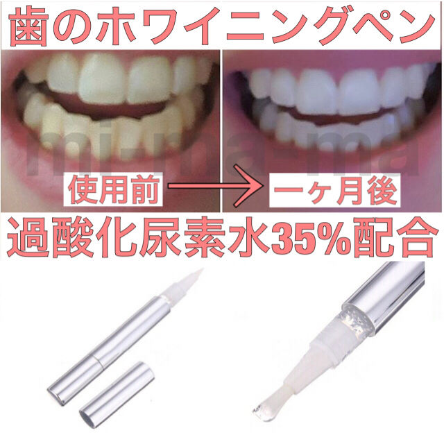 歯が真っ白 歯のホワイトニングペン 送料無料 フリマアプリ サイトshoppies ショッピーズ